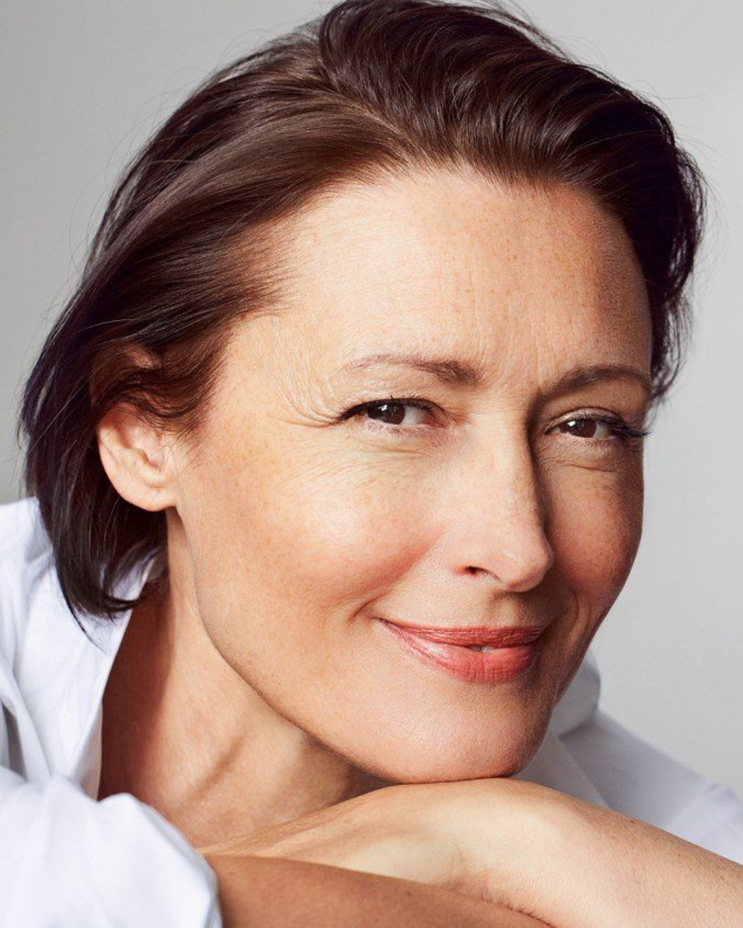 El poder de los neuromoduladores: rejuvenecer la piel sin perder su naturalidad