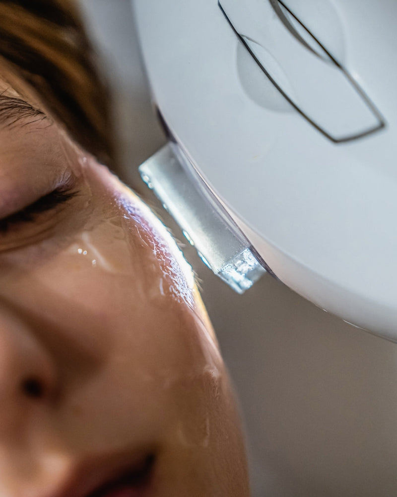 Fotorejuvenecimiento IPL en Madrid — Elimina Manchas, Rojeces y Recupera la Luminosidad de tu Piel
