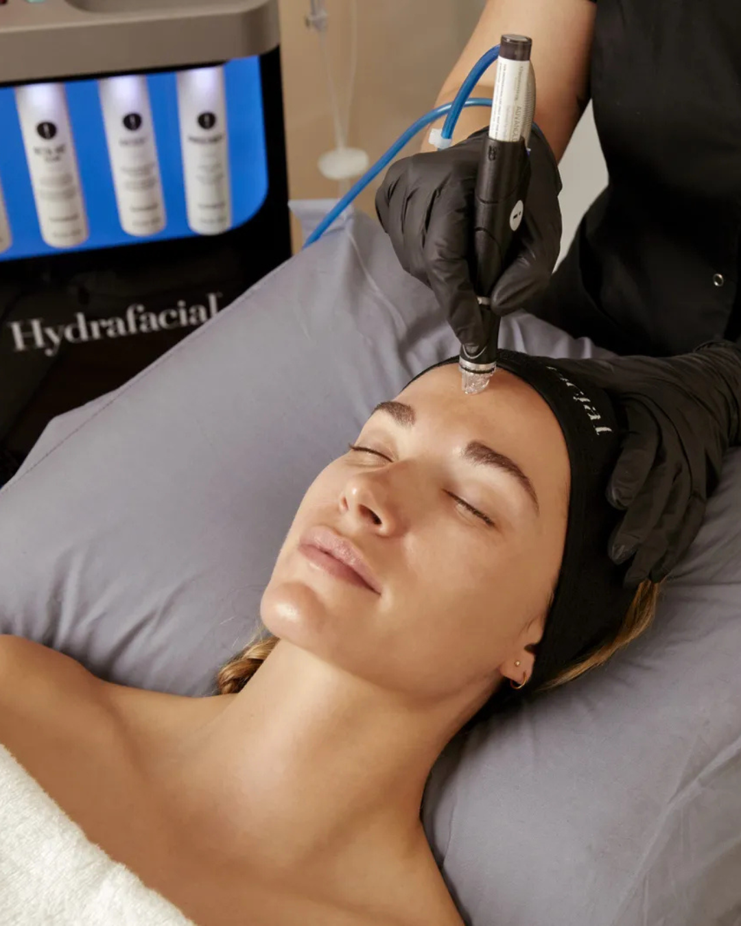 Hydrafacial Deluxe: qué incluye esta sesión y para quién es ideal