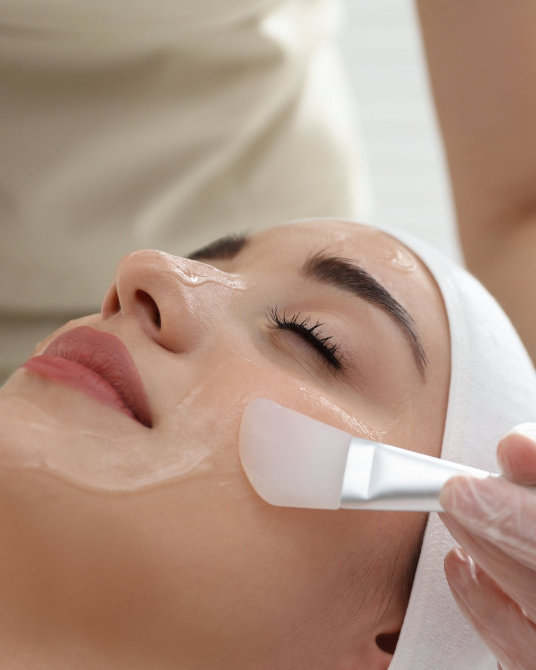 Peeling químico médico