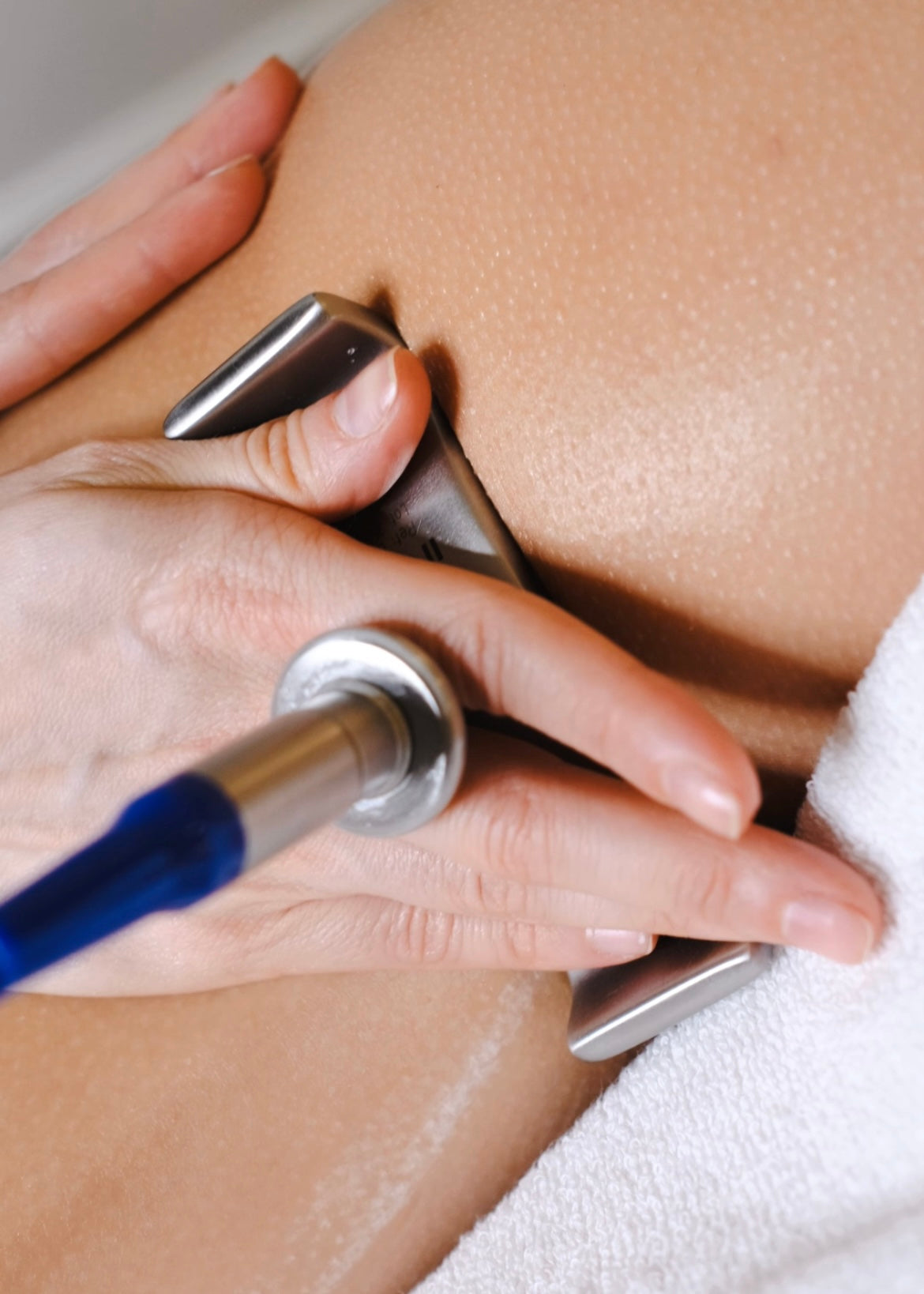 Indiba corporal: el tratamiento más eficaz para celulitis, flacidez y grasa localizada