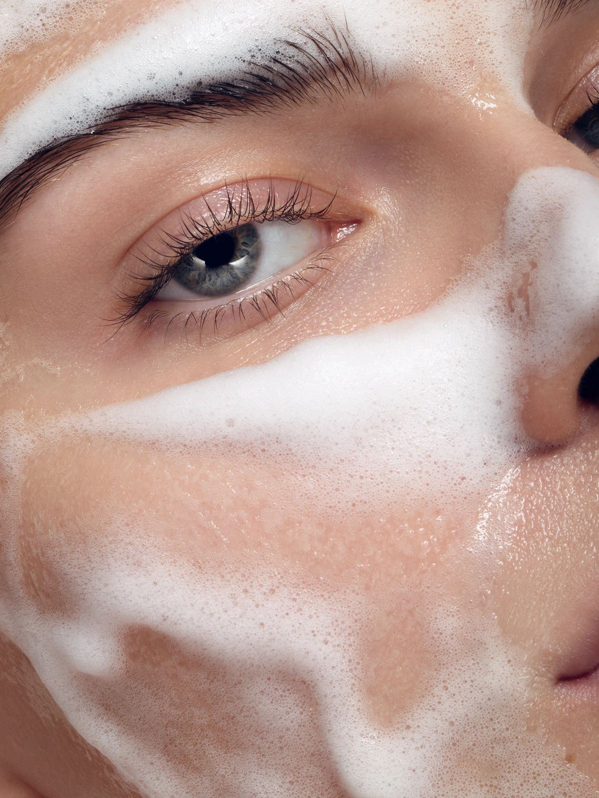 Rosácea: qué es y cómo calmar la piel con un enfoque experto