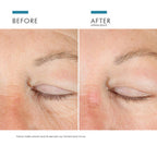 Complexe oculaire AGE