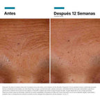 Sérum A.G.E. Interrupter Ultra