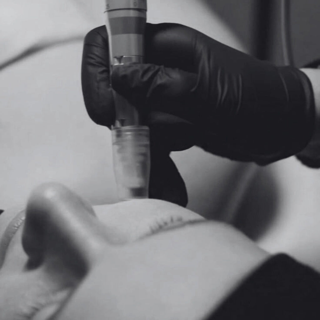 Facial dermapen