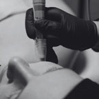 Facial dermapen