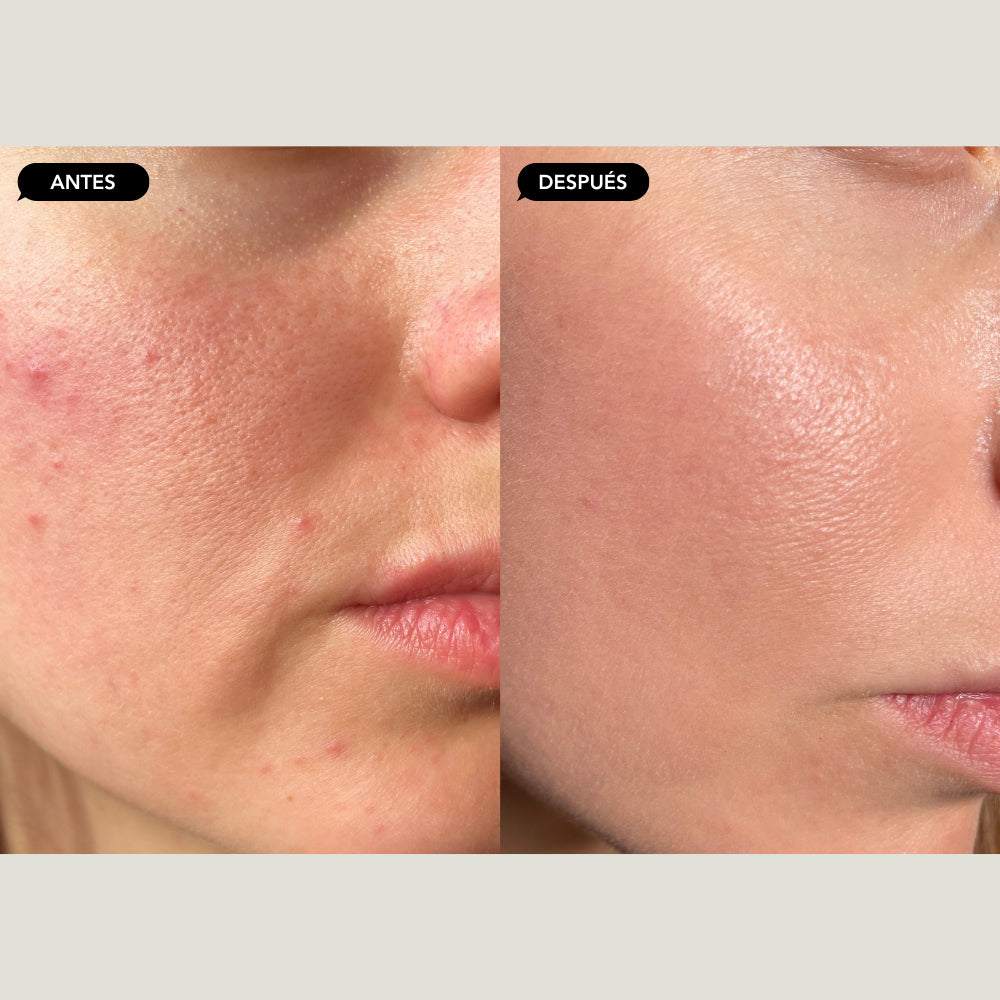 Facial detox