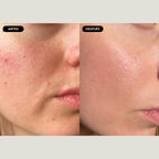 Facial detox