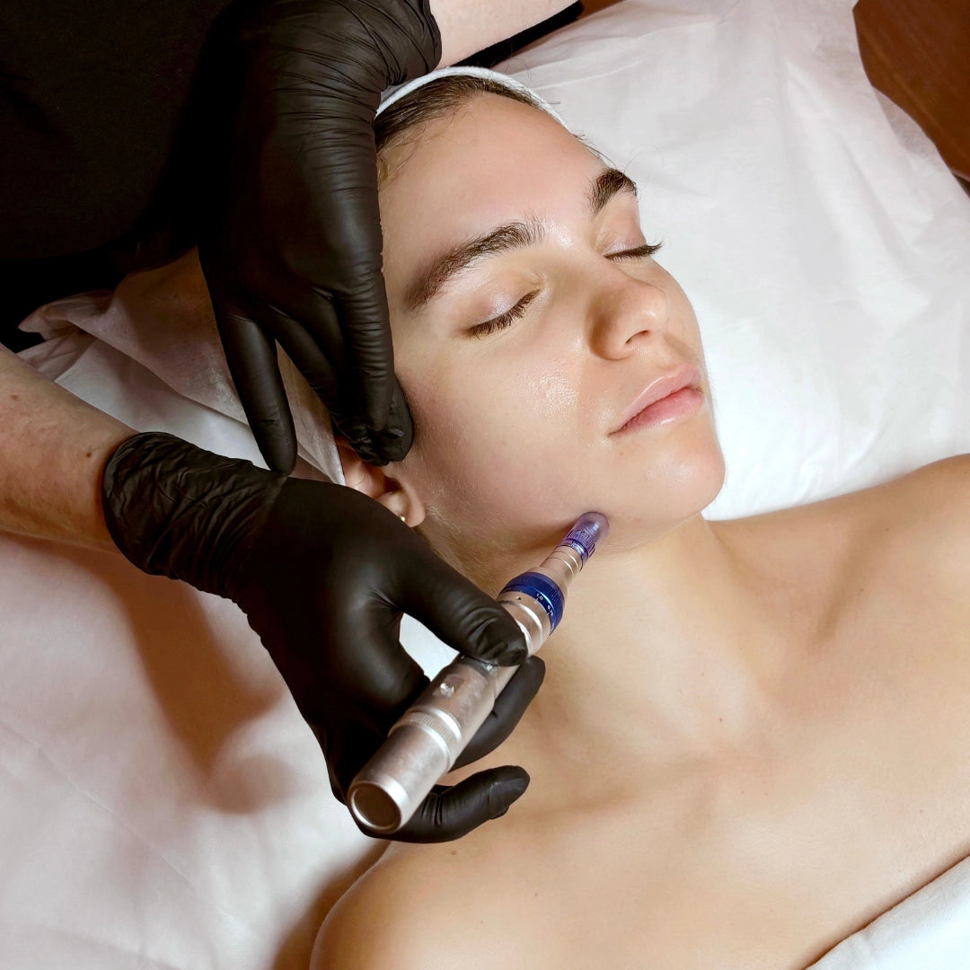Tratamiento Facial Exosomas