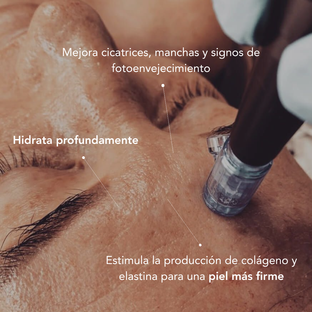 Tratamiento Facial Exosomas
