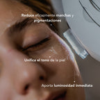 Tratamiento Anti Manchas con IPL