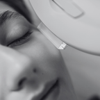 IPL Anti-Imperfection Treatment