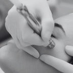 Microdermabrasion