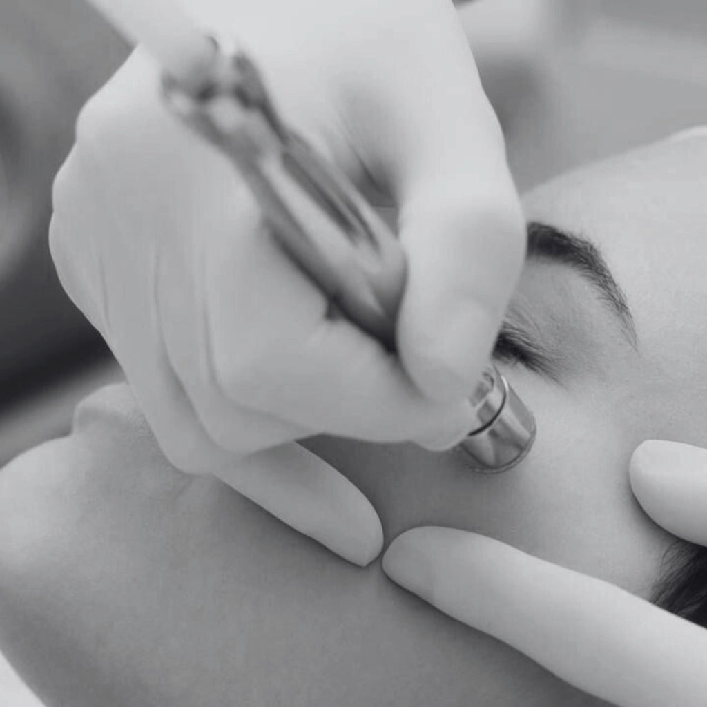 Carte cadeau microdermabrasion