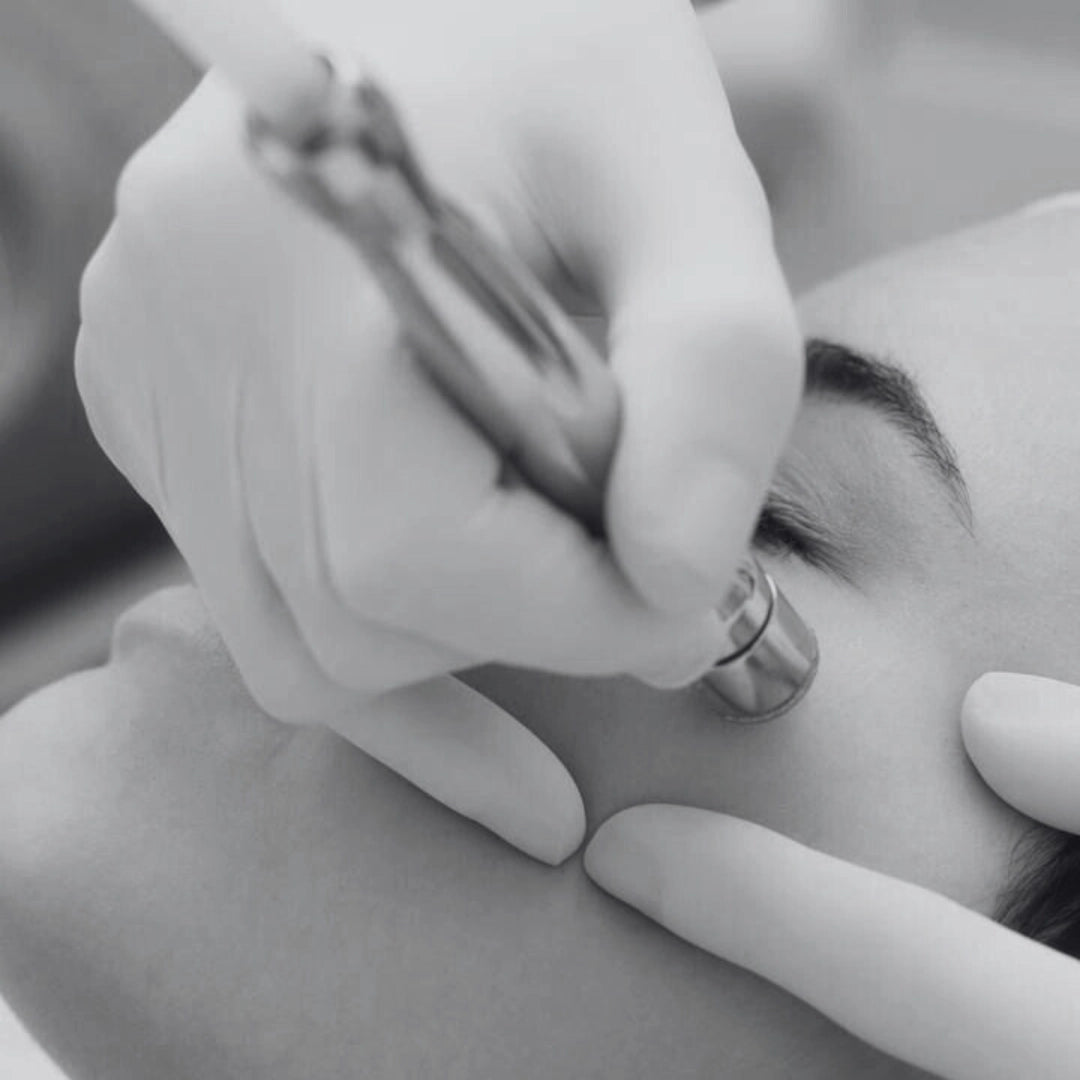 Carte cadeau microdermabrasion