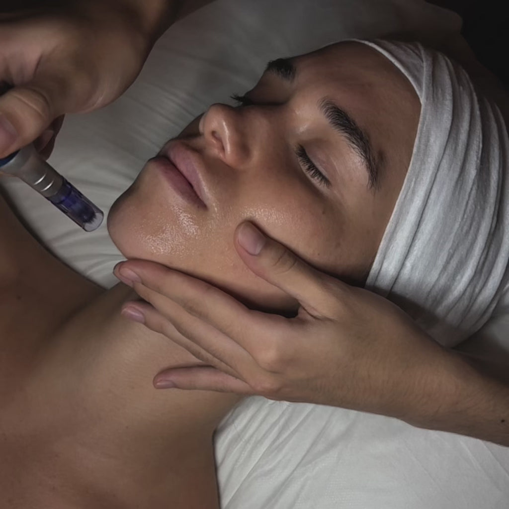 Facial dermapen