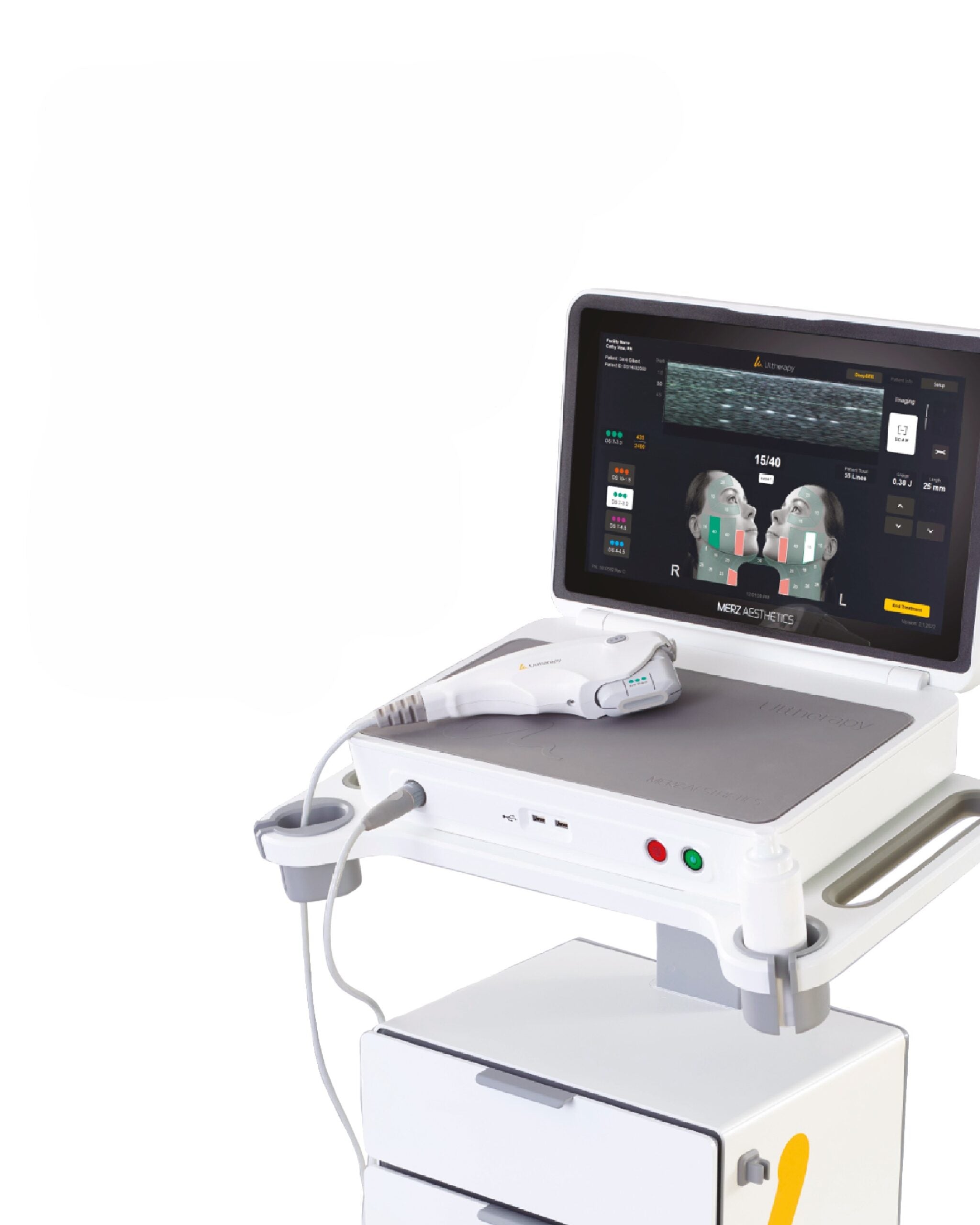 Ultherapy Prime Rostro