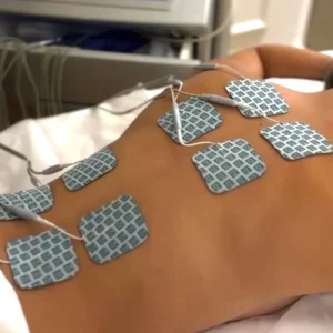 biostimulación de ultratone