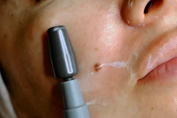 indiba instant beauty