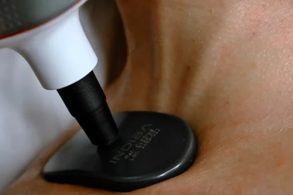 indiba instant beauty