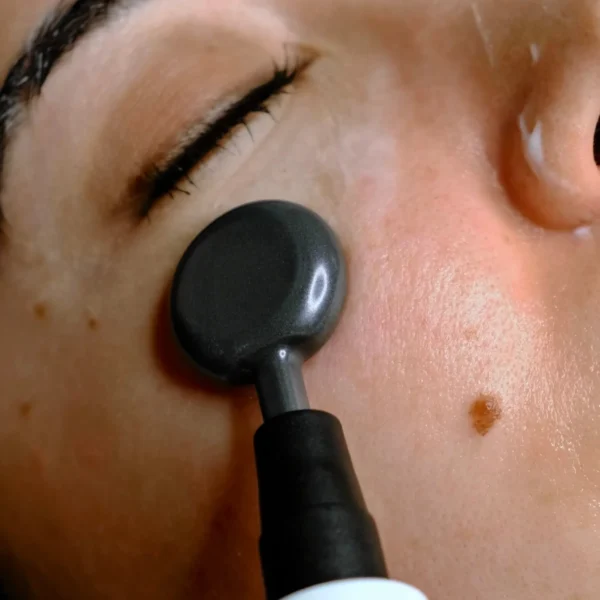 indiba instant beauty