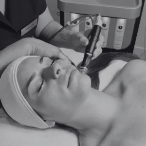 hydrafacial platinum