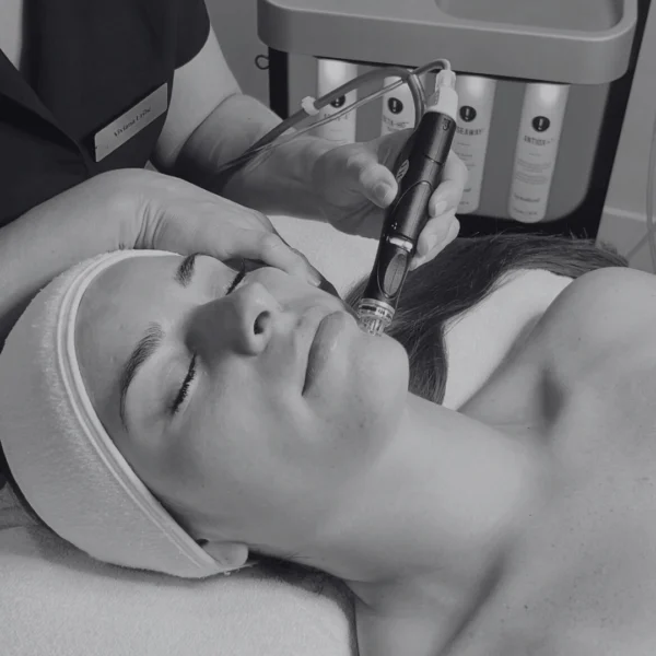 hydrafacial platinum