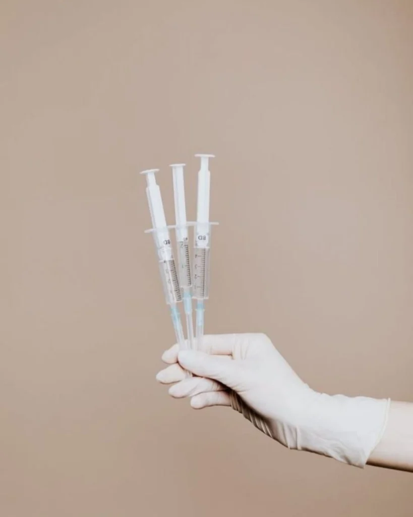 Jeringas con ácido hialurónico listas para un tratamiento estético de relleno facial.