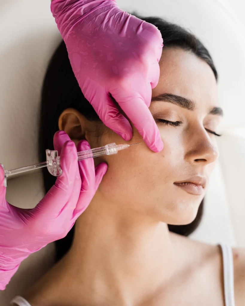 Aplicación profesional de ácido hialurónico en el rostro para mejorar volumen y reducir arrugas.