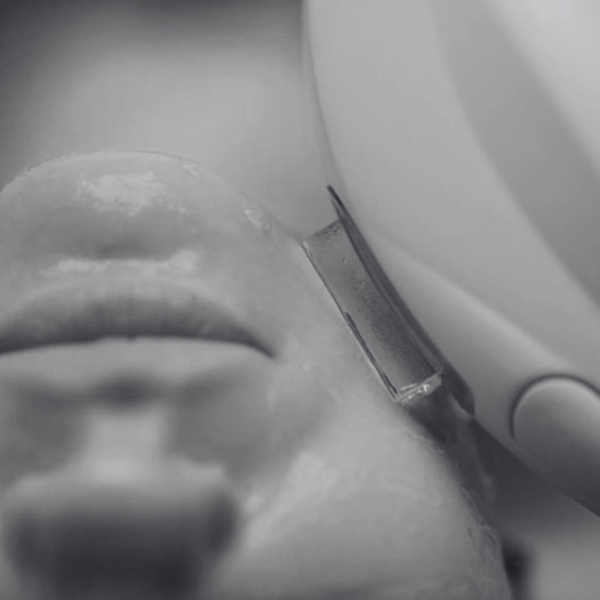 tratamiento de rejuvenecimiento con ipl