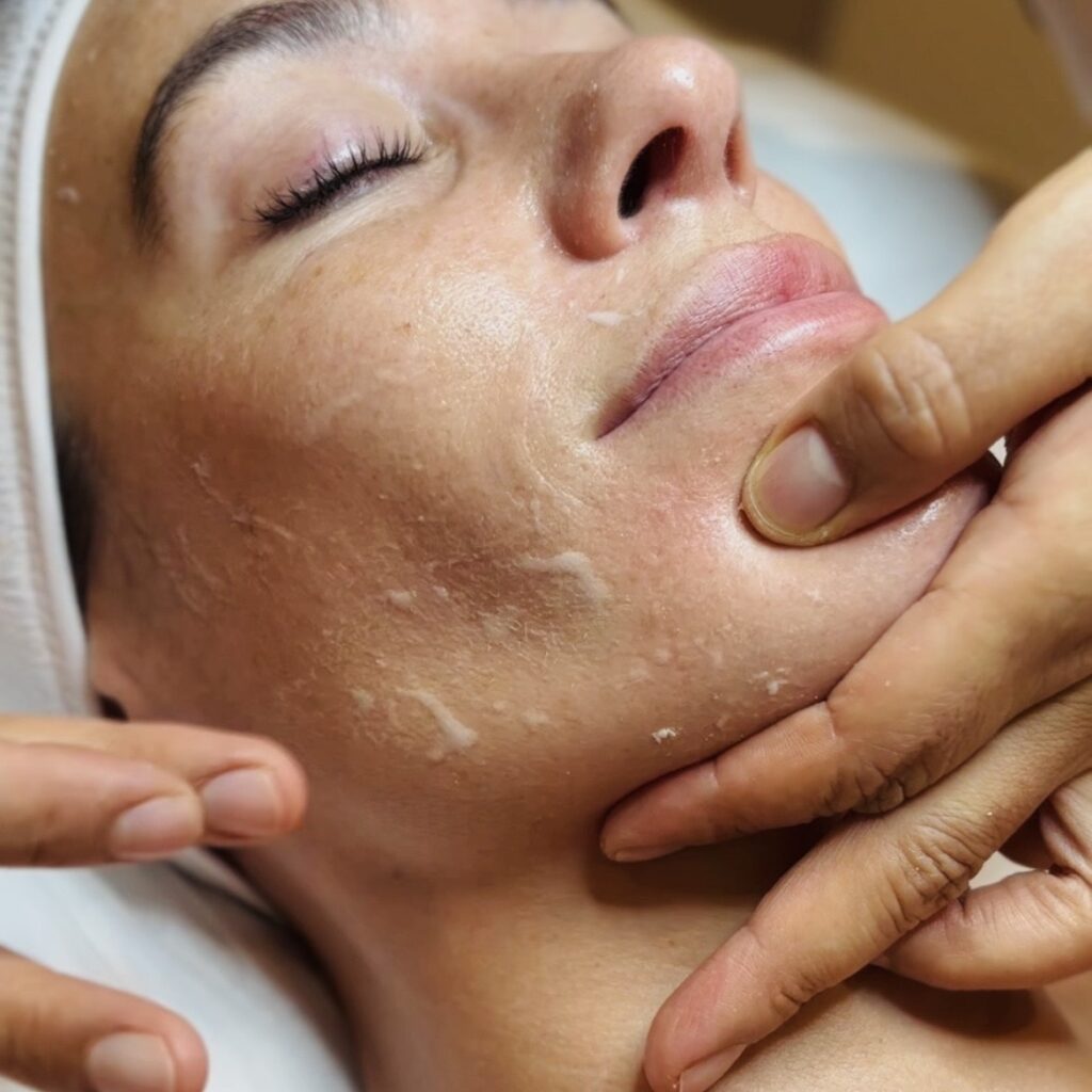 Frasco de vitamina C y rostro femenino con piel luminosa, mostrando los efectos de este tratamiento antioxidante.