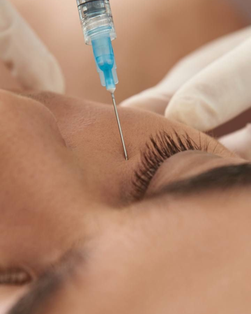 Primer plano de un rostro con piel hidratada y revitalizada tras un tratamiento con polinucleótidos y ácido hialurónico.