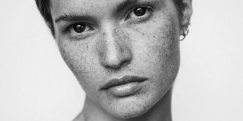 Rostro de mujer con piel luminosa y uniforme, efecto del ácido hialurónico en la hidratación y elasticidad.