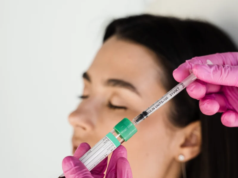 Extracción de sangre para tratamiento facial con plasma en Beldon Medical