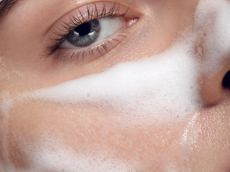 Rostro femenino con enrojecimiento característico de la rosácea, mostrando una piel más calmada tras tratamiento especializado.