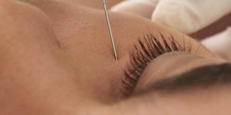 Primer plano de un rostro con piel hidratada y revitalizada tras un tratamiento con polinucleótidos y ácido hialurónico.