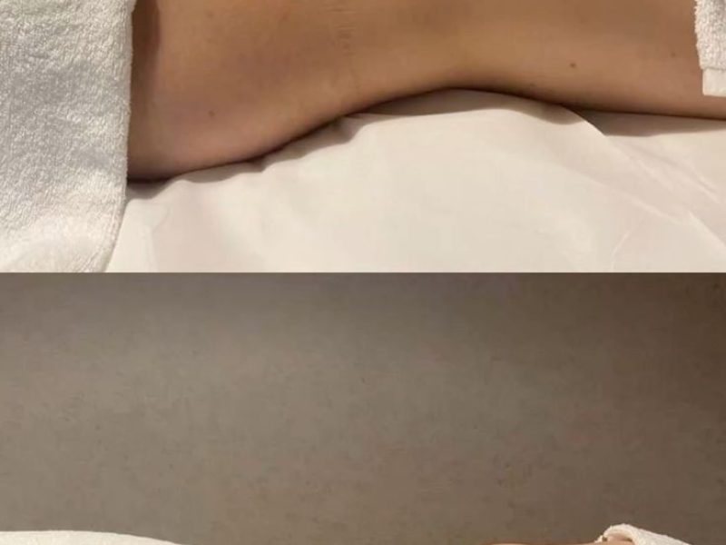 Presoterapia en centro estético con botas neumáticas para drenaje linfático y resultados visibles con plan de sesiones.