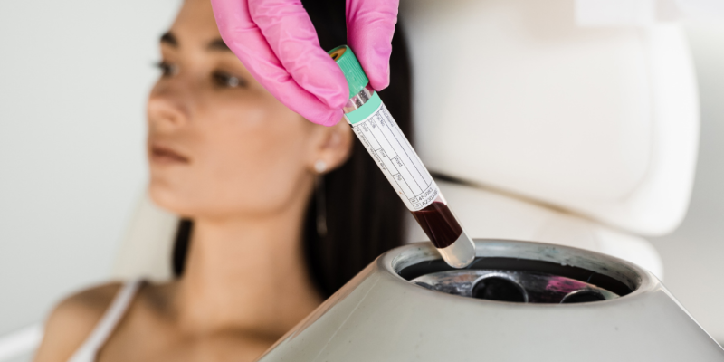 Rostro con piel rejuvenecida y luminosa tras un tratamiento de regeneración celular con plasma autólogo.