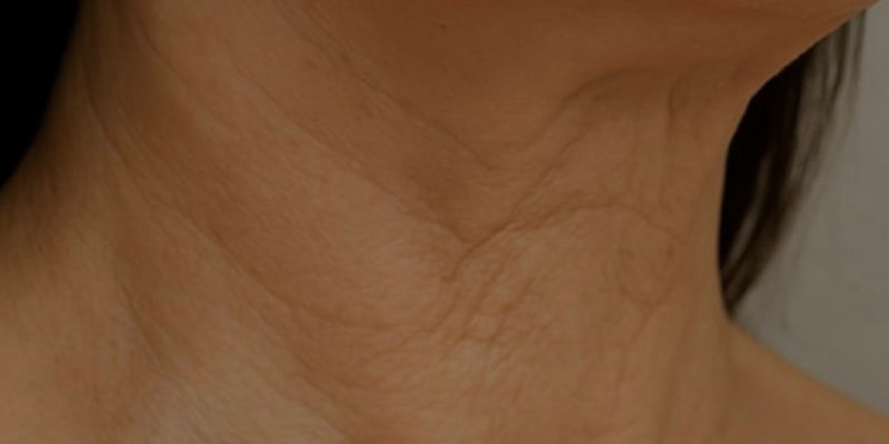 Primer plano de un rostro con piel rejuvenecida y luminosa tras un tratamiento de terapia celular.