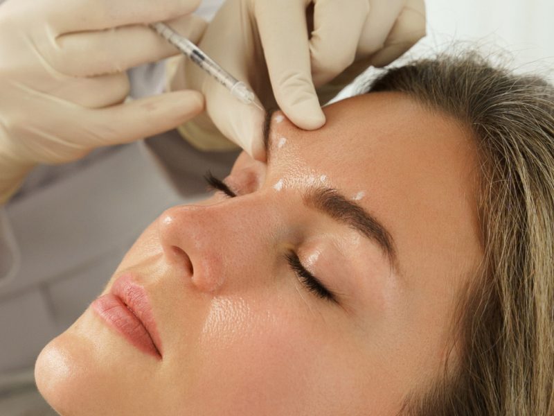 Tratamiento colágeno