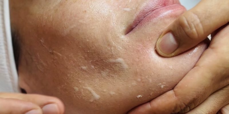 Frasco de vitamina C y rostro femenino con piel luminosa, mostrando los efectos de este tratamiento antioxidante.